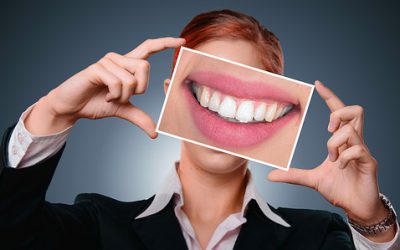 4 feiten over tandheelkundige implantaten